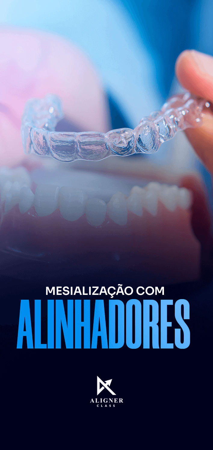 05 - Mesialização com alinhadores - Vertical