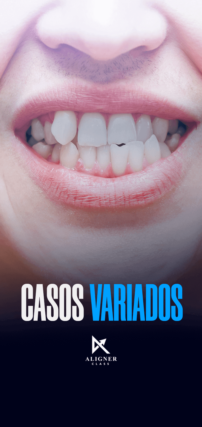 08 - Casos Variados - Vertical