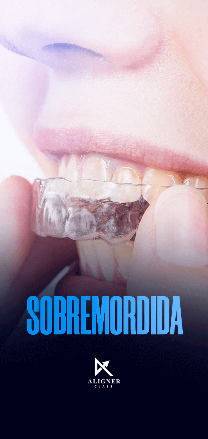 10 - Sobremordida - Vertical