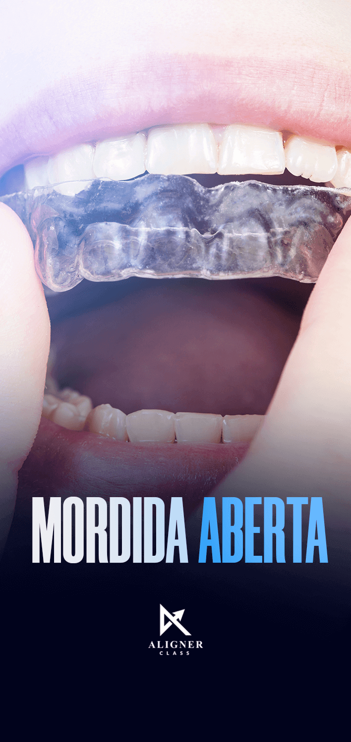 11 - Mordida Aberta - Vertical