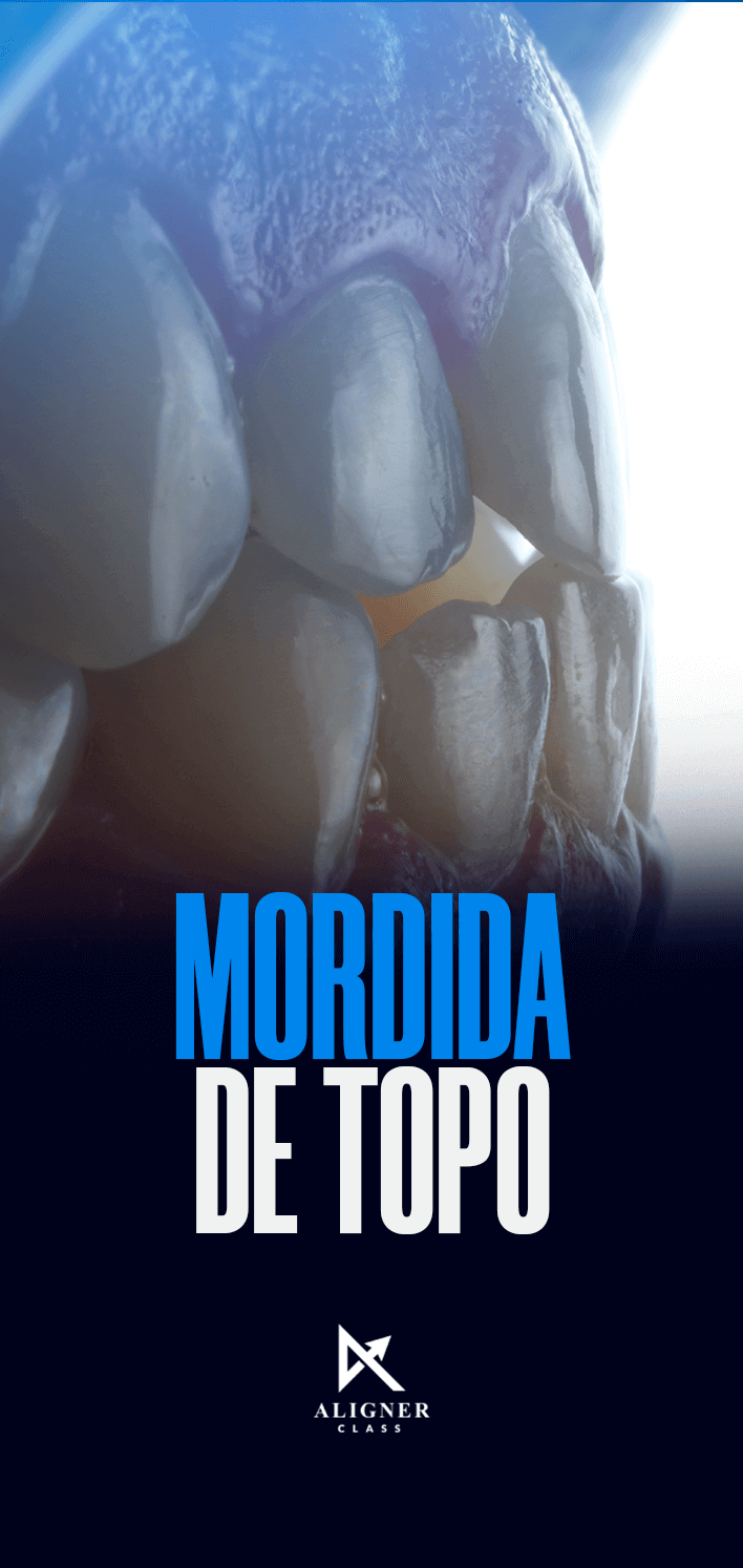 12 - Mordida de topo - Vertical