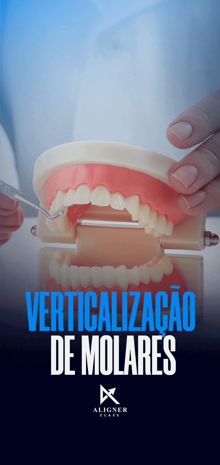 13 - Verticalização de molares - Vertical