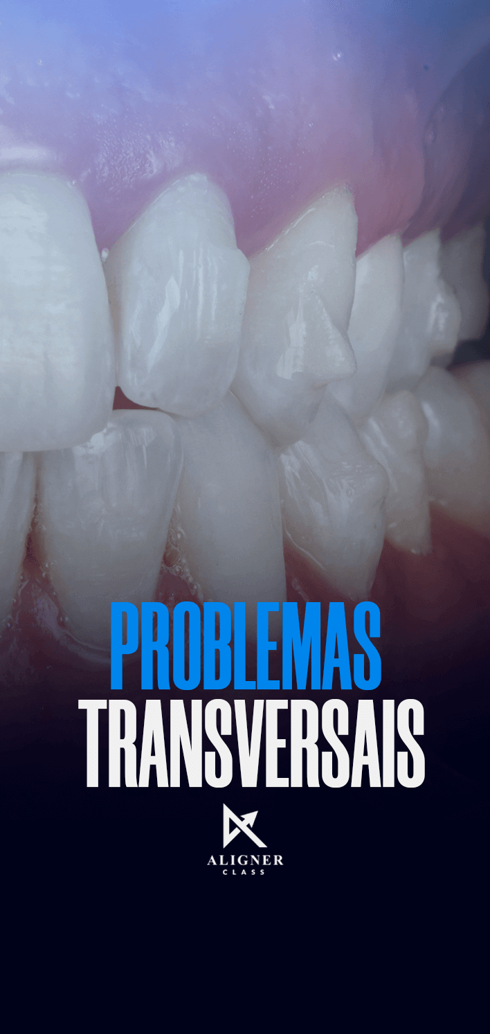 14 - Problemas Transversais - Vertical