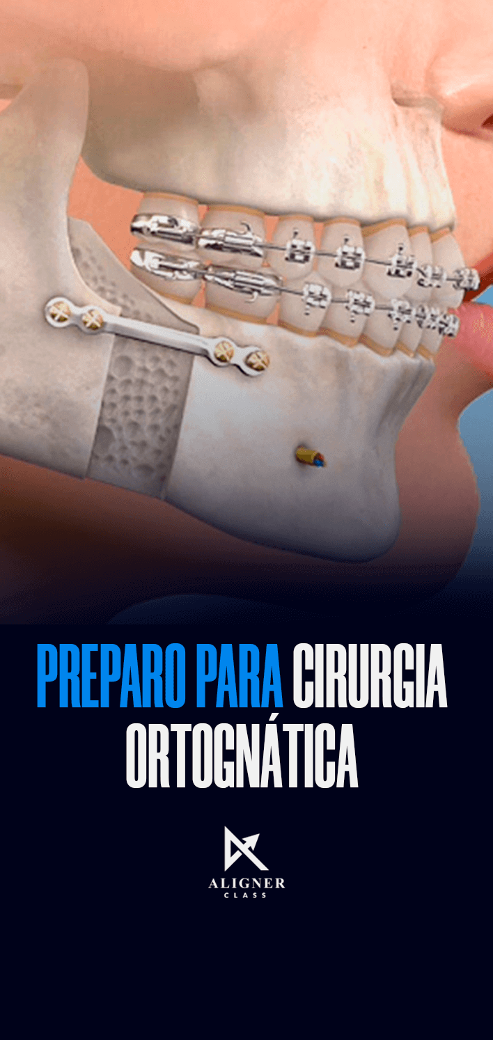 18 - Preparo para cirurgia - Vertical